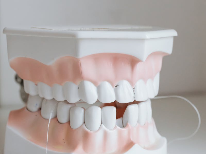 Preventive dental care
